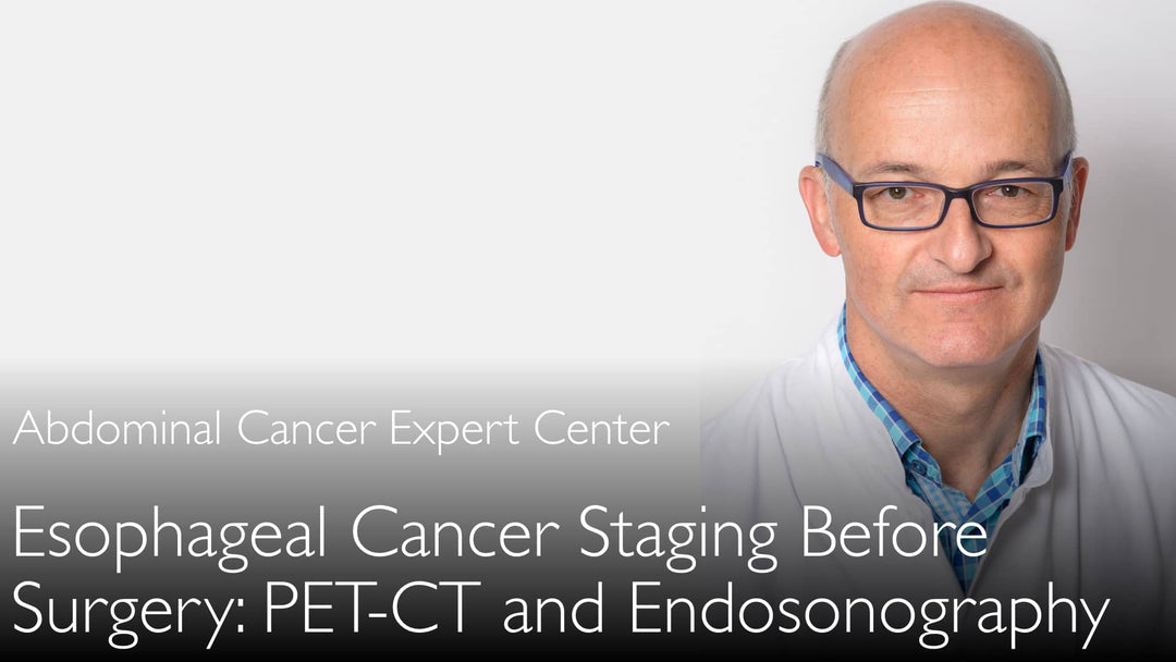 Staging of esophageal cancer before surgery. PET-CT and endosonography. 8